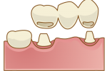 crown014
